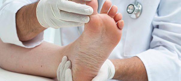 How to Find a Podiatrist in Eastwood